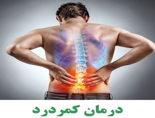 درمان کمردرد با طب سوزنی در اصفهان