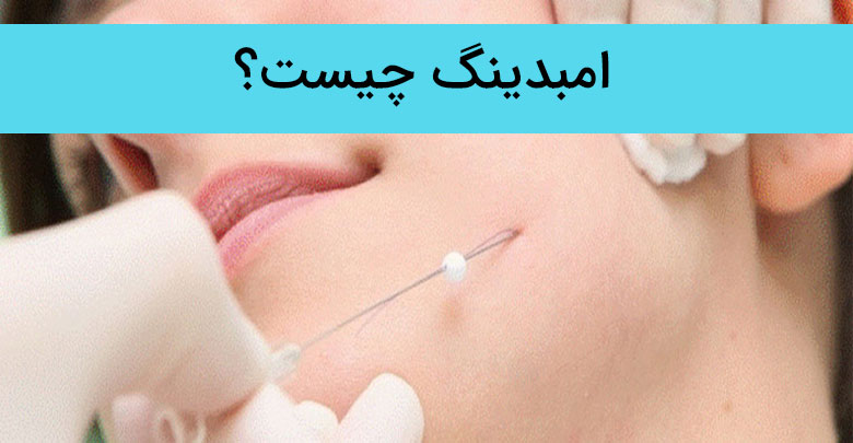 امبدینگ چیست ، امبدینگ در اصفهان