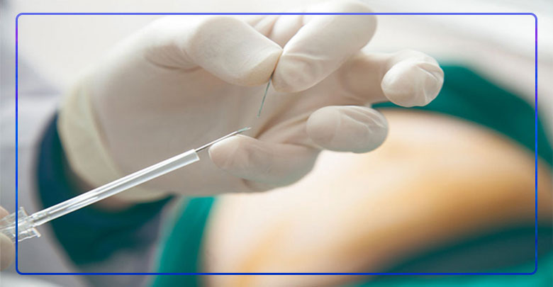 سوزن امبدینگ ، کاشت نخ در اصفهان