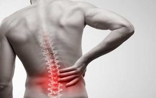 درمان کمردرد