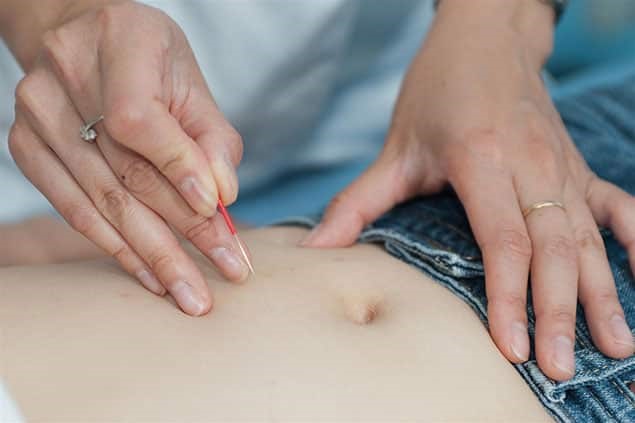 لاغری شکم با طب سوزنی