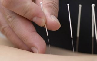 طب سوزنی چه بیماری هایی را درمان میکند؟