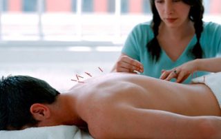 طب سوزنی برای اعصاب