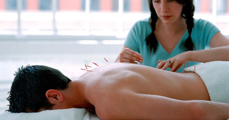 طب سوزنی برای اعصاب