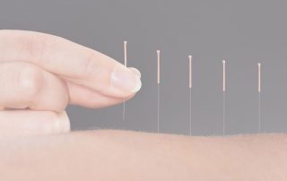 بهترین دکتر طب سوزنی در اصفهان