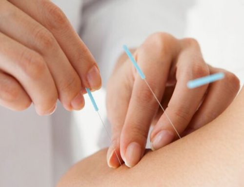 متخصص طب سوزنی در اصفهان