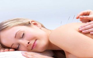 هزینه طب سوزنی در اصفهان