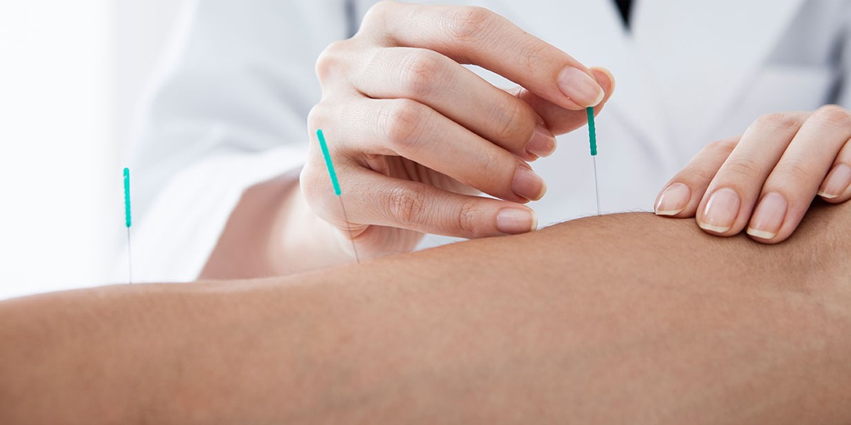 بهترین دکتر طب سوزنی در اصفهان