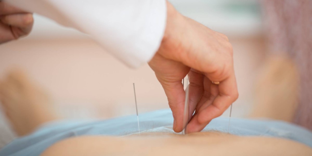 بهترین متخصص طب سوزنی در اصفهان