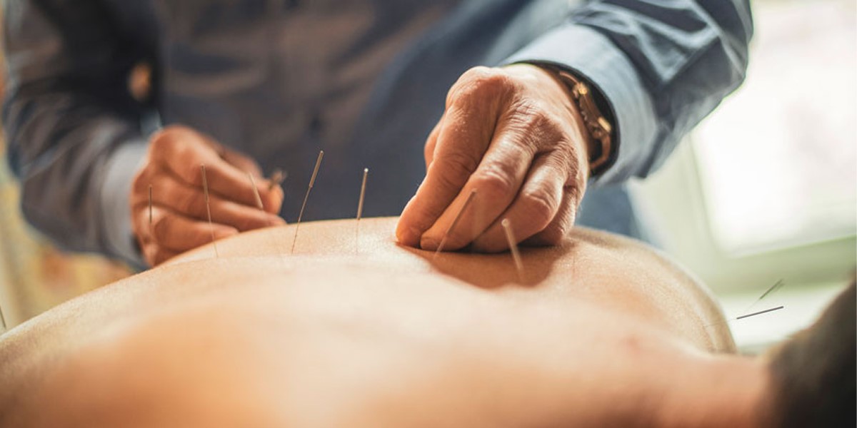 دکتر طب سوزنی