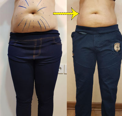 انجام امبدینگ
امبدینگ در اصفهان