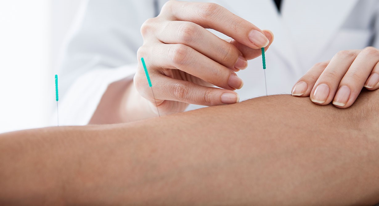 طب سوزنی در اصفهان