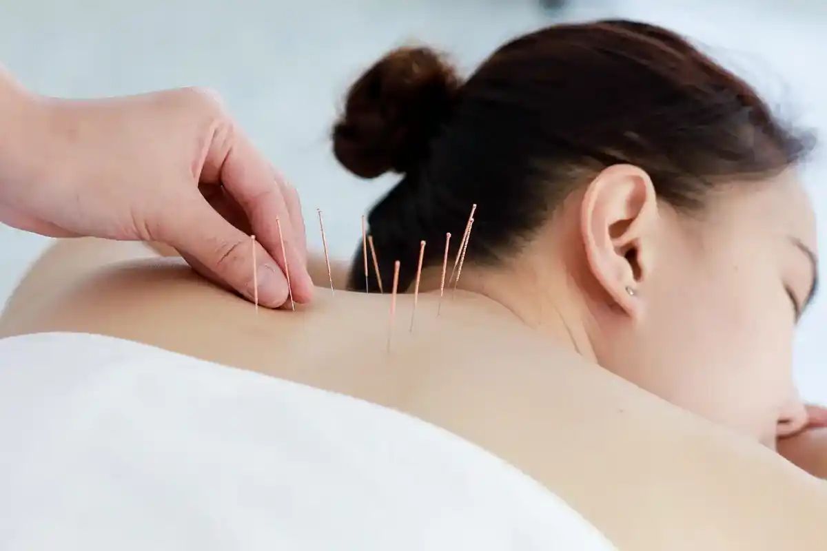 درمان افسردگی و اضطراب با طب سوزنی