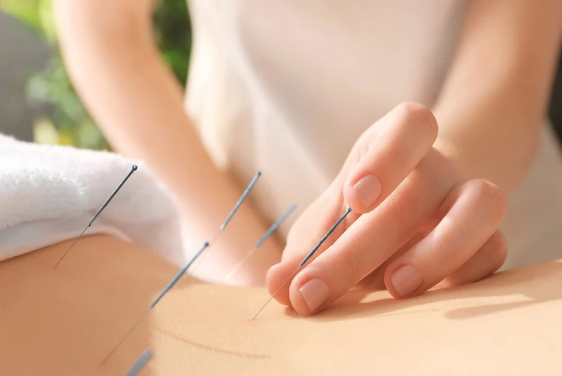 رفع یائسگی زودرس با طب سوزنی