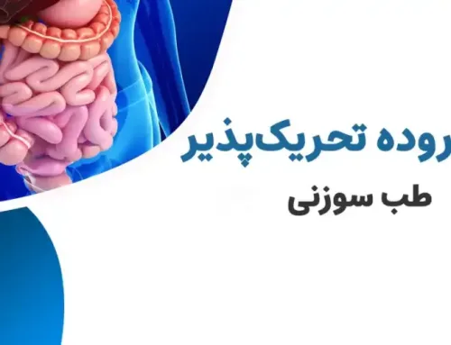 درمان روده تحریک پذیر با طب سوزنی؛ روشی طبیعی و موثر